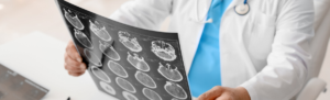 Image of doctor looking at brain scans.