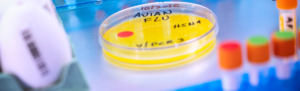 Petri dish that states Avian Flu